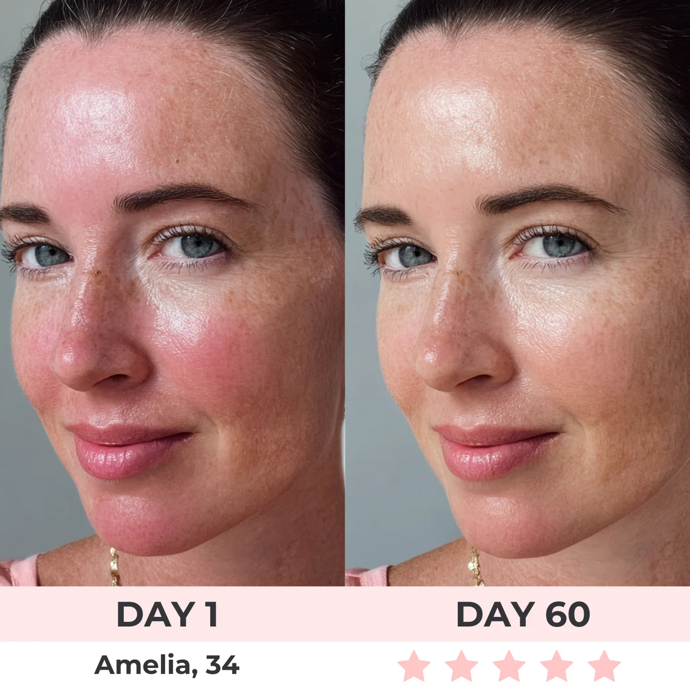 LISSIA REGENERATION™