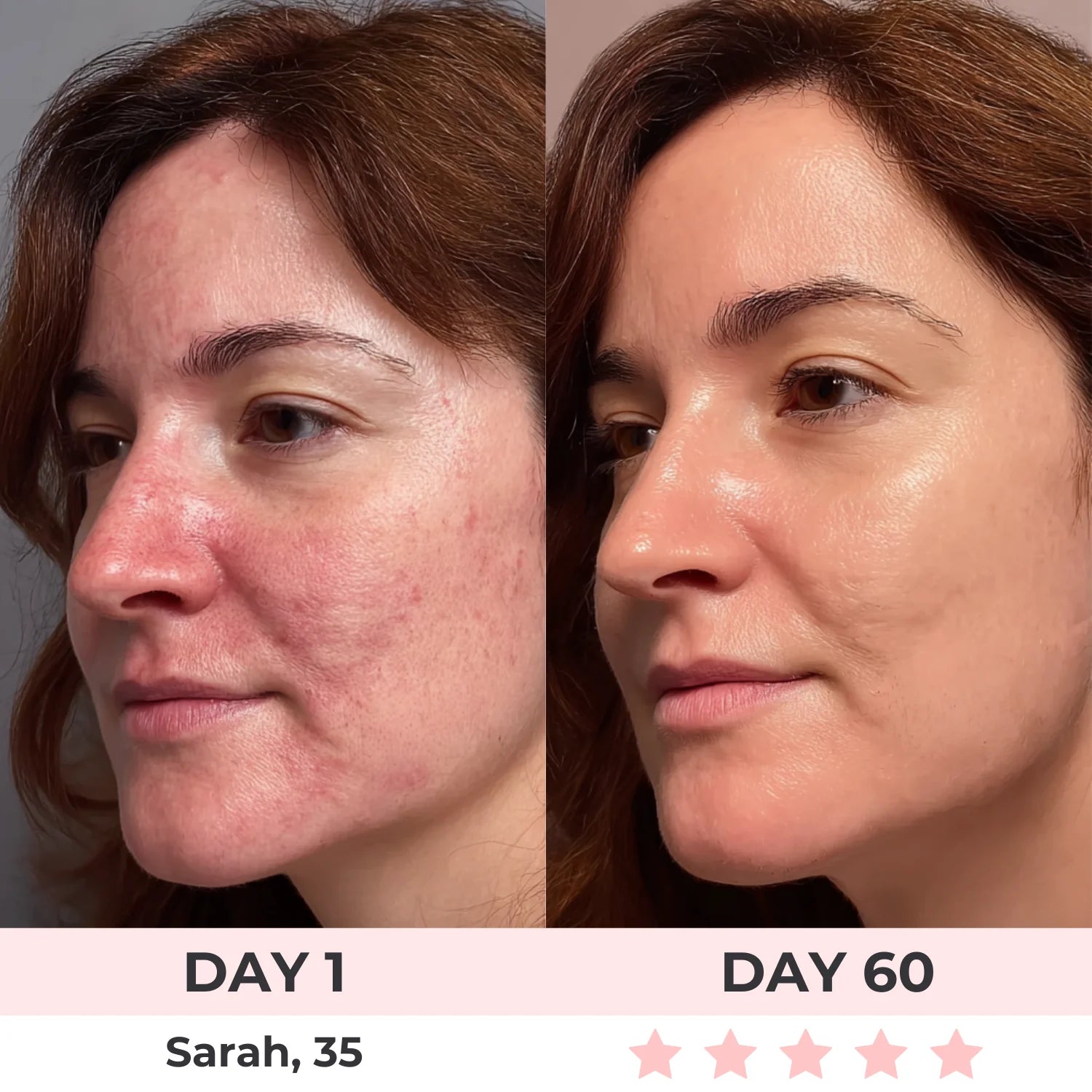 LISSIA REGENERATION™